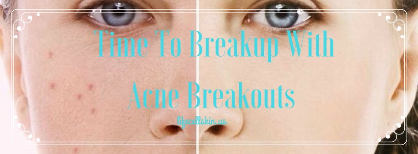 Acne Breakouts