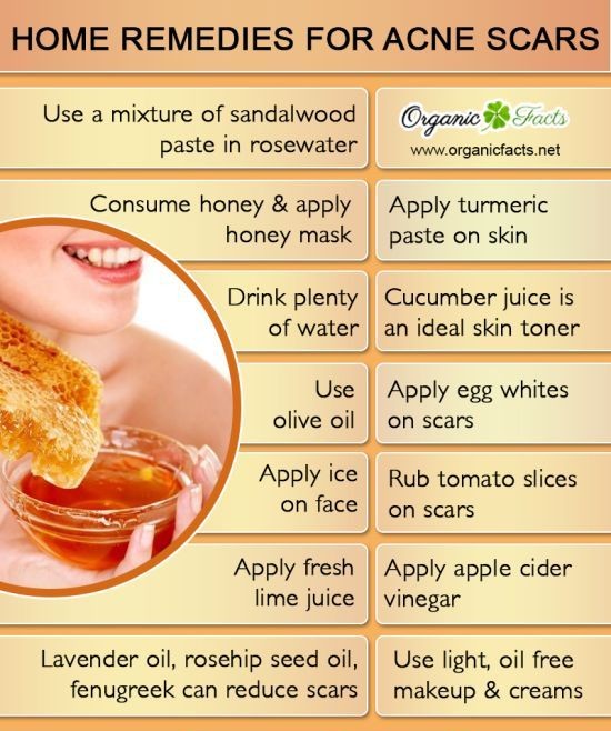 how to remove pimple scars home remedies