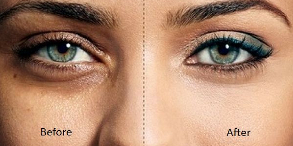 Remove dark circles naturally