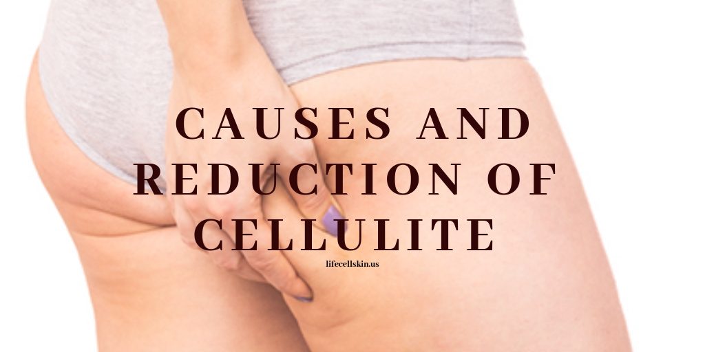 How To Reduce Cellulite